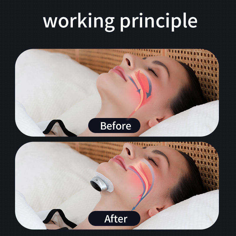 Sleep Apnea Aid Treatment Tool for Better Sleep